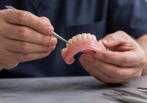 Understanding Denture Repair: Frequency, Signs, and Best Practices