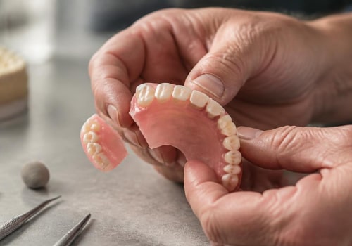 Can You Fix a Broken Denture? Understanding Your Repair Options