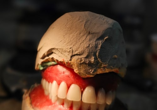 Denture Repair and Emergency Dental Services in Basel